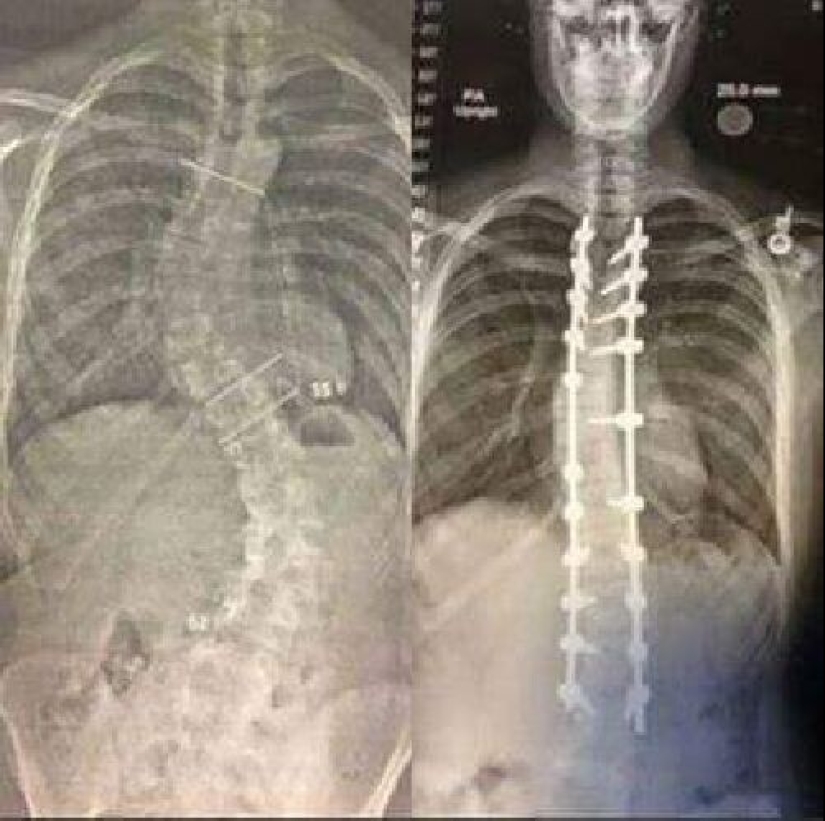 50 fotos "antes y después" que puedes mirar sin cesar