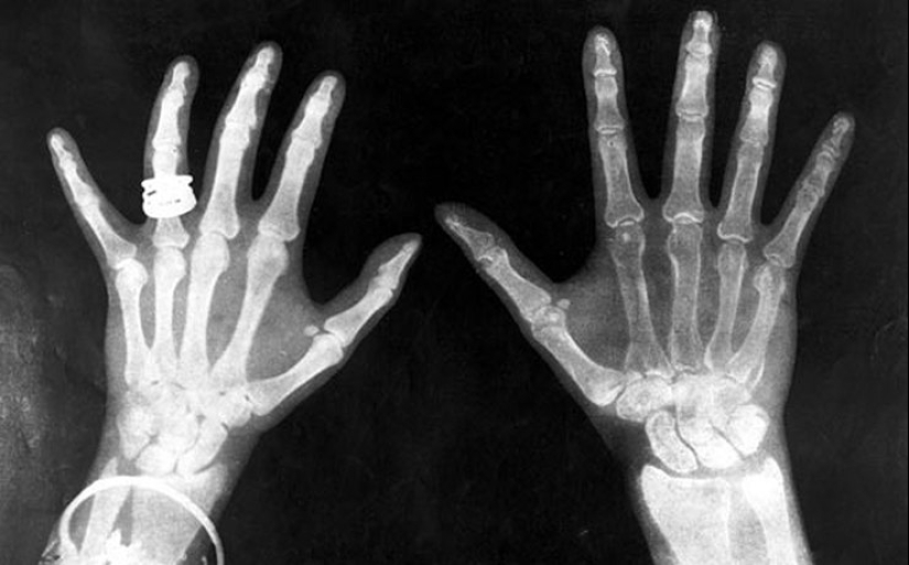 6 peligroso cosméticos del pasado, de la cual la mujer murió dolorosamente 6 peligroso cosméticos del pasado, de la cual la mujer murió dolorosamente