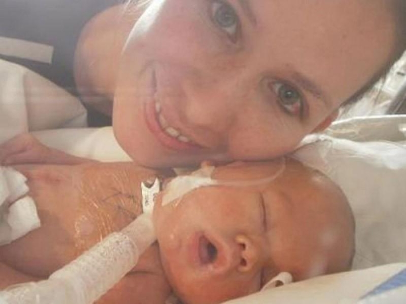 7 incredible stories of survival of babies