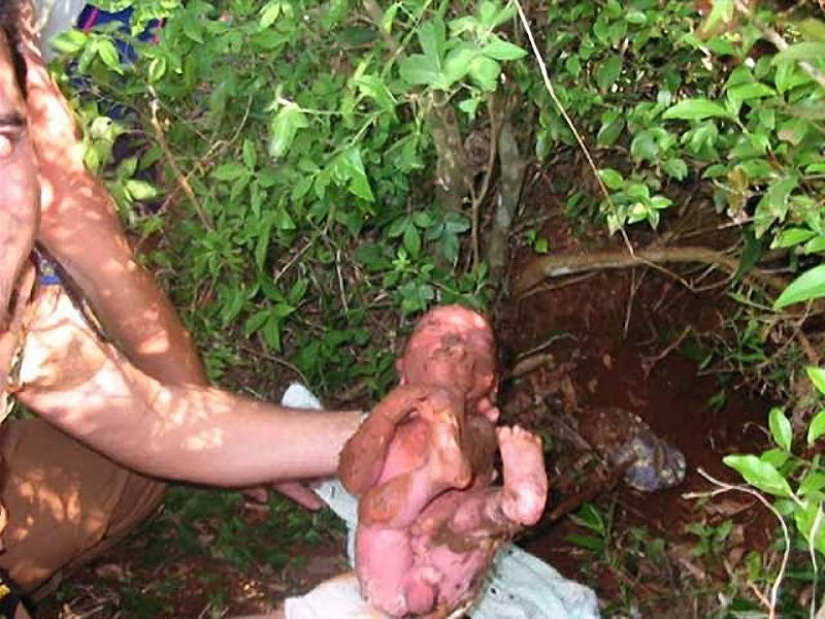 7 incredible stories of survival of babies