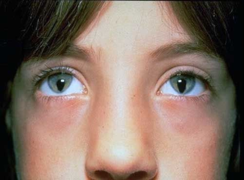 8 anomalies that demonstrate how unpredictable genetics