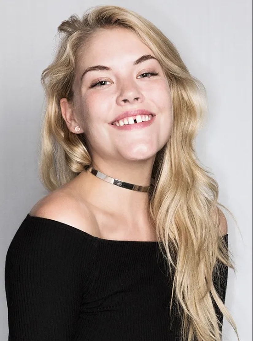 A flaw or a highlight? Madonna and other stars with a gap between their teeth