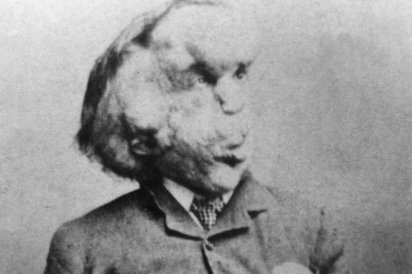 A Freak with a Beautiful Soul: The Story of Joseph Merrick-The Elephant Man A Freak with a Beautiful Soul: The Story of Joseph Merrick-The Elephant Man