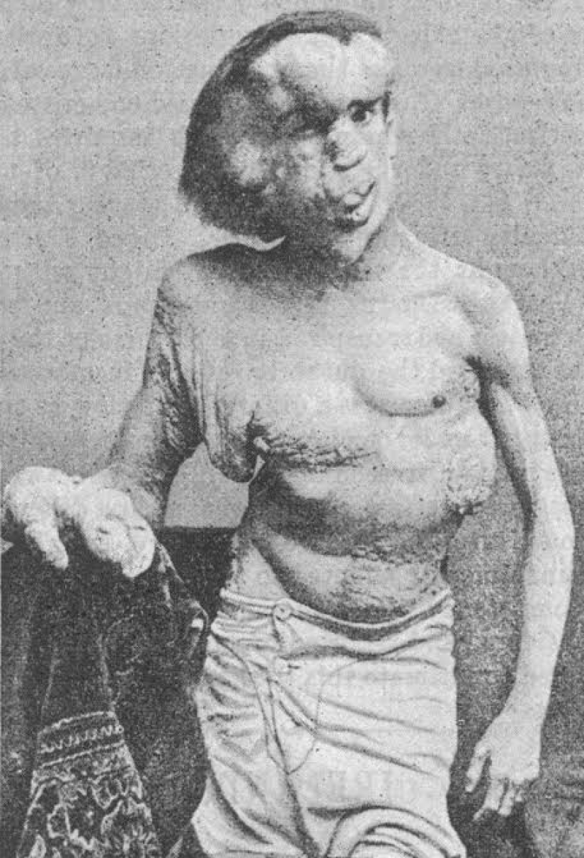 A Freak with a Beautiful Soul: The Story of Joseph Merrick-The Elephant Man A Freak with a Beautiful Soul: The Story of Joseph Merrick-The Elephant Man