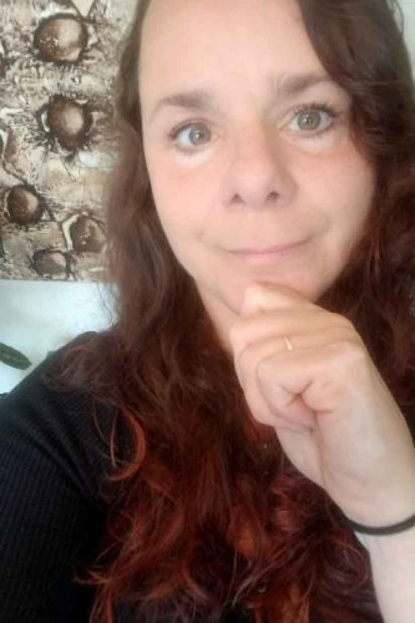 A hair scrunchie almost made a woman disabled