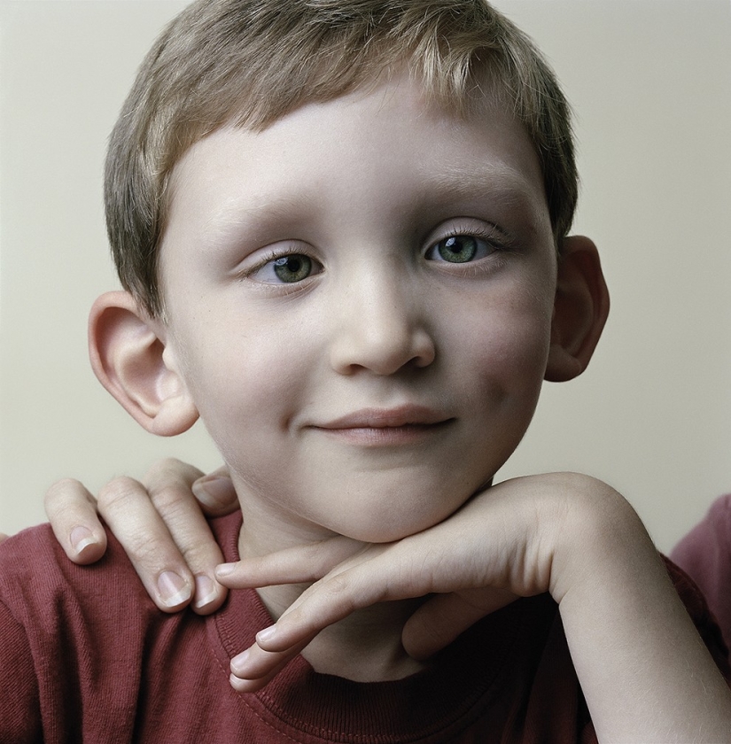 About Face: photo portraits of people suffering from paralysis About Face: photo portraits of people suffering from paralysis