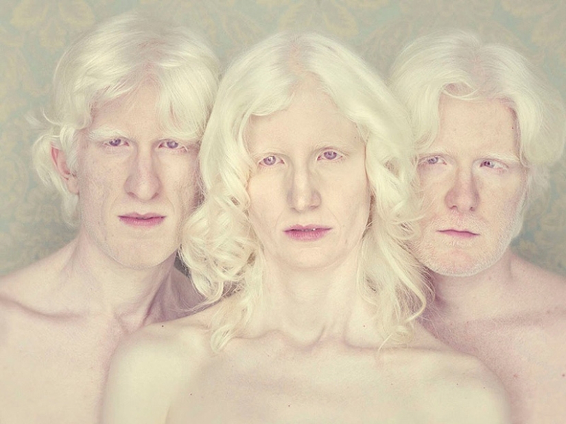 Albinos en la lente de Gustavo Lacerde