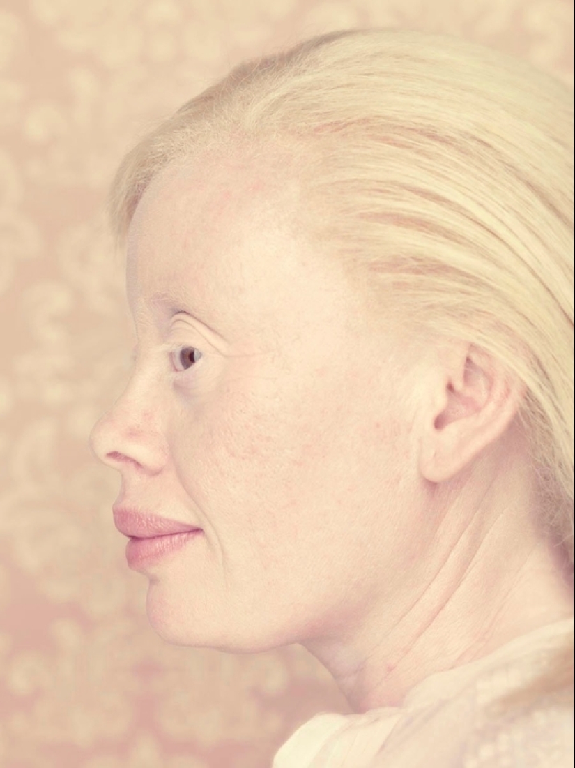 Albinos en la lente de Gustavo Lacerde