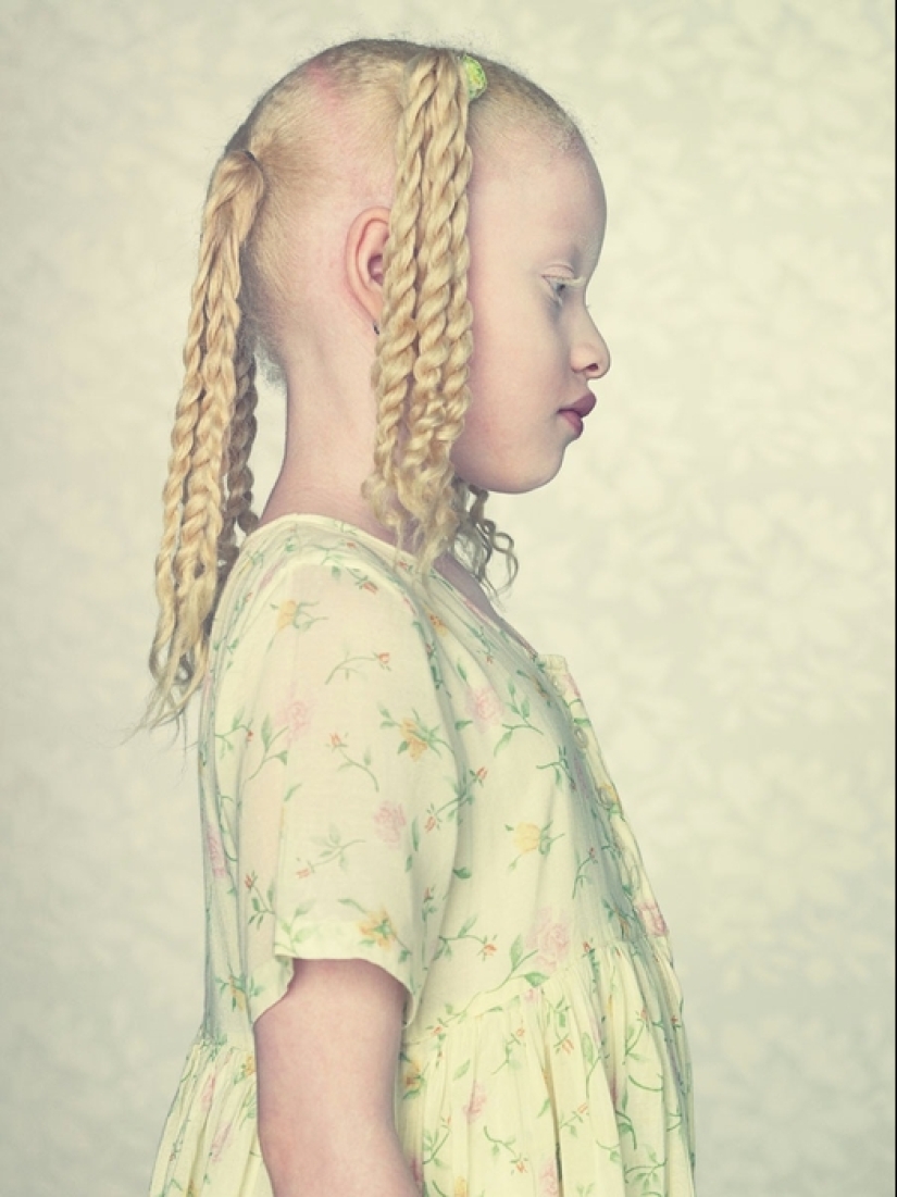 Albinos en la lente de Gustavo Lacerde