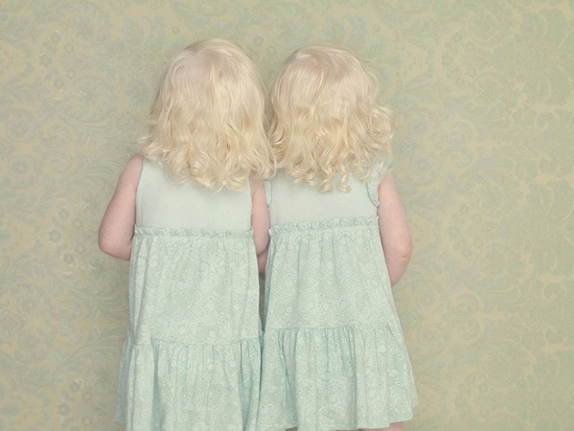 Albinos en la lente de Gustavo Lacerde