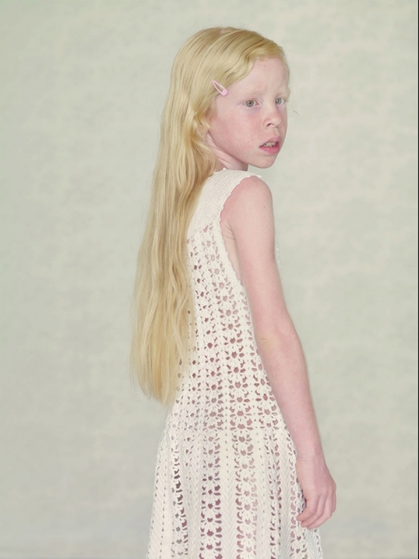 Albinos en la lente de Gustavo Lacerde