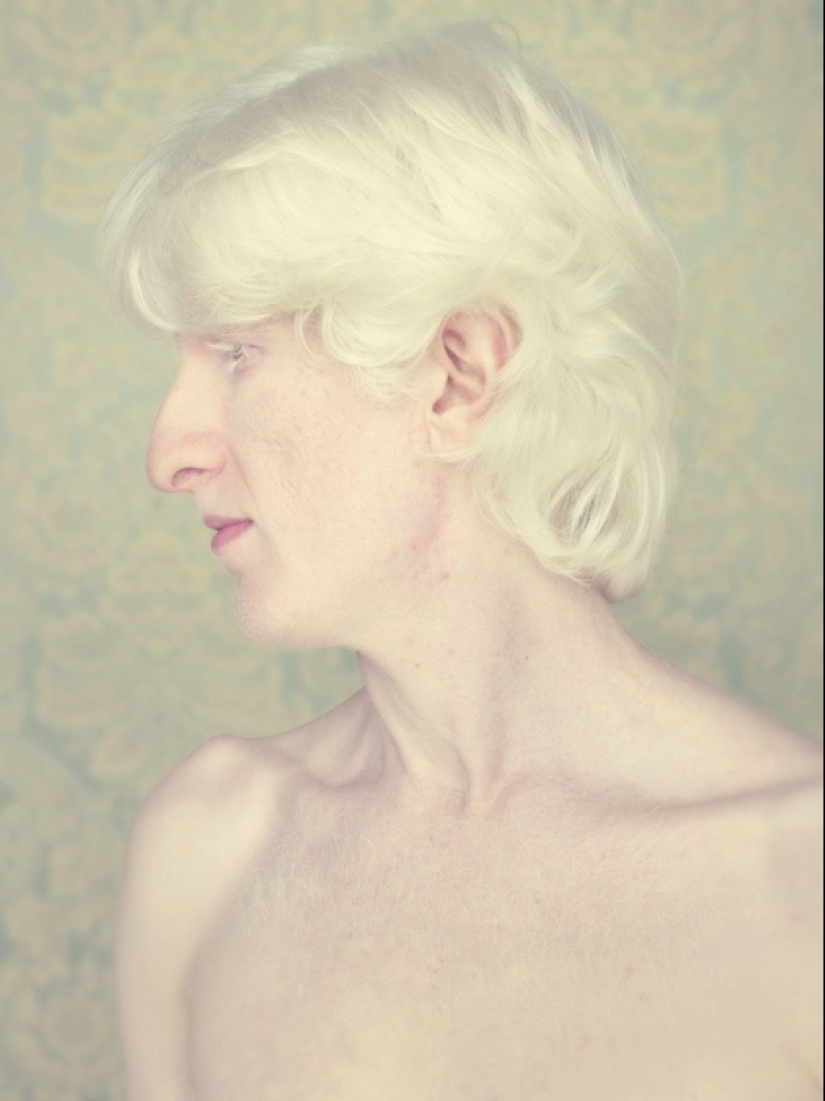 Albinos en la lente de Gustavo Lacerde