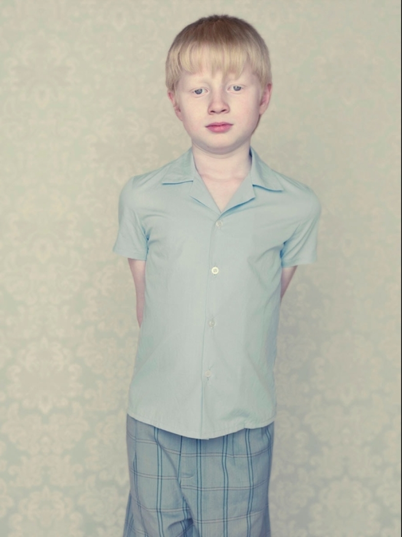 Albinos en la lente de Gustavo Lacerde