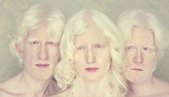 Albinos in the lens of Gustavo Lacerde
