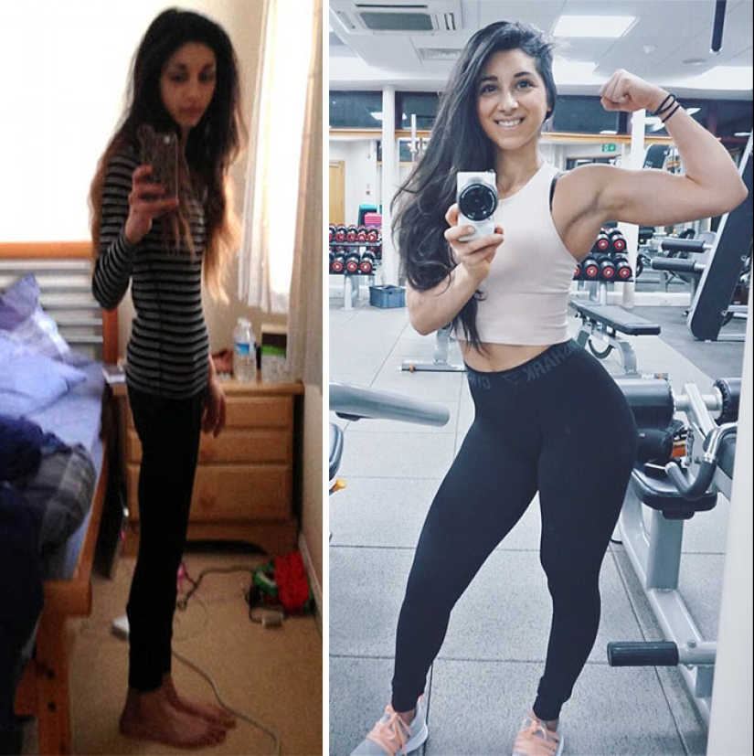 Antes y después: 20 ejemplos de personas que lograron superar la anorexia