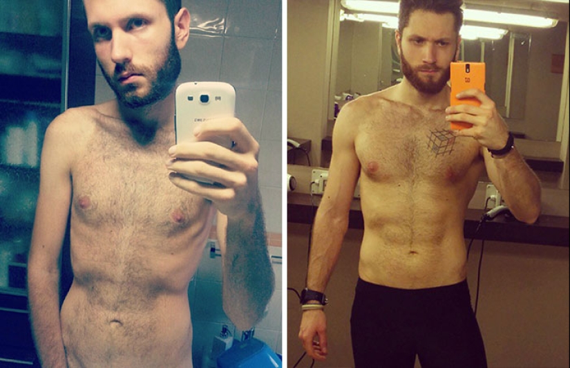 Antes y después: 20 ejemplos de personas que lograron superar la anorexia