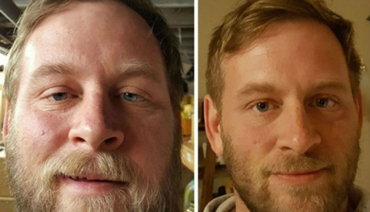 Antes y después: cómo cambia la apariencia de una persona que deja de beber