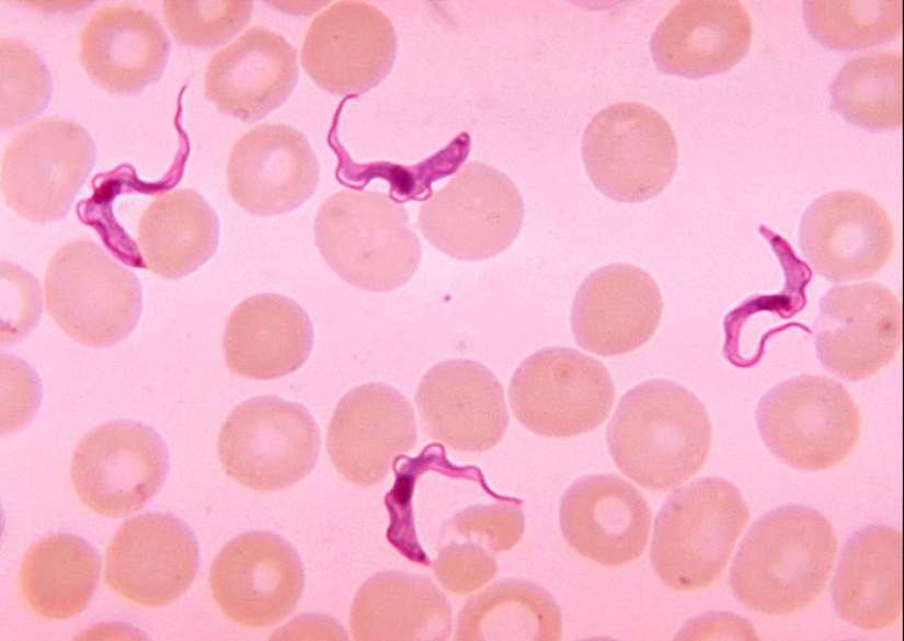 "Are you out of your mind?": 10 parasites and pathogens that control the human mind "Are you out of your mind?": 10 parasites and pathogens that control the human mind
