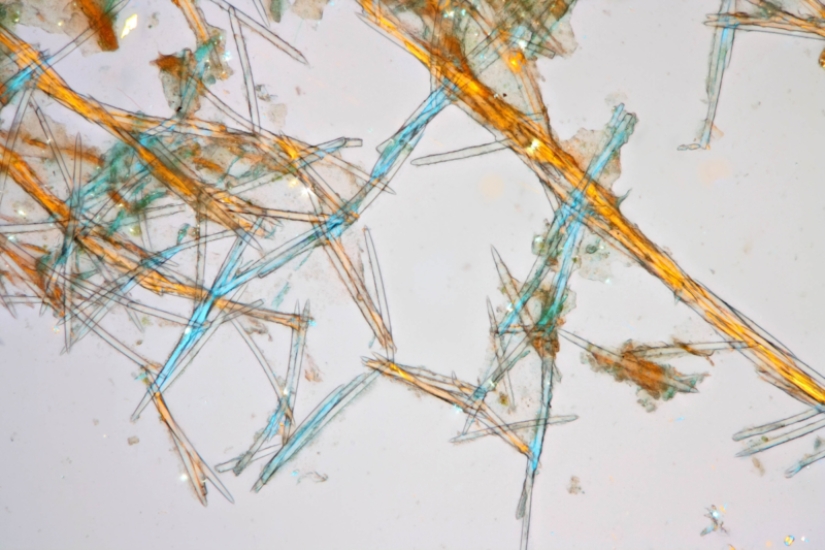 Badyaga: te salva de moretones, y ni siquiera sabes que no es una planta Badyaga: te salva de moretones, y ni siquiera sabes que no es una planta