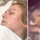 Before and after: 20 photos of people who decided to stop using drugs Before and after: 20 photos of people who decided to stop using drugs