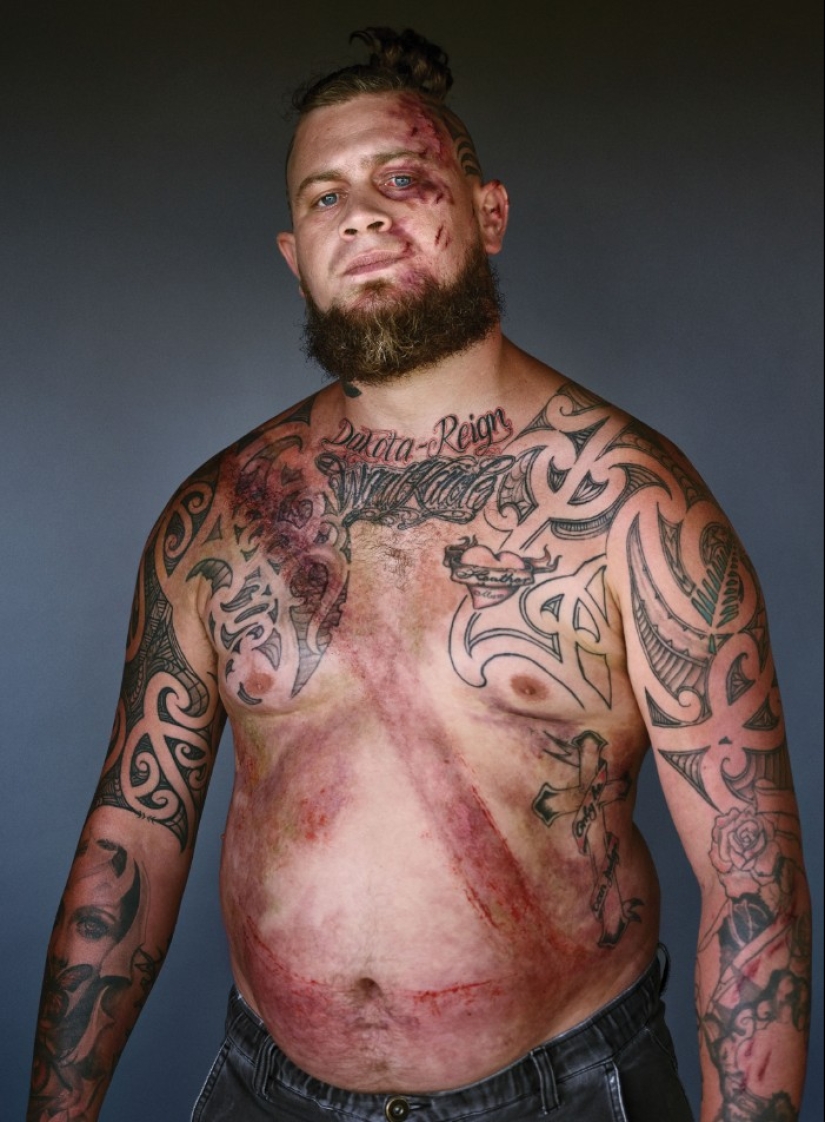 Belt survivors: 10 magnificent photos that will convince you to wear