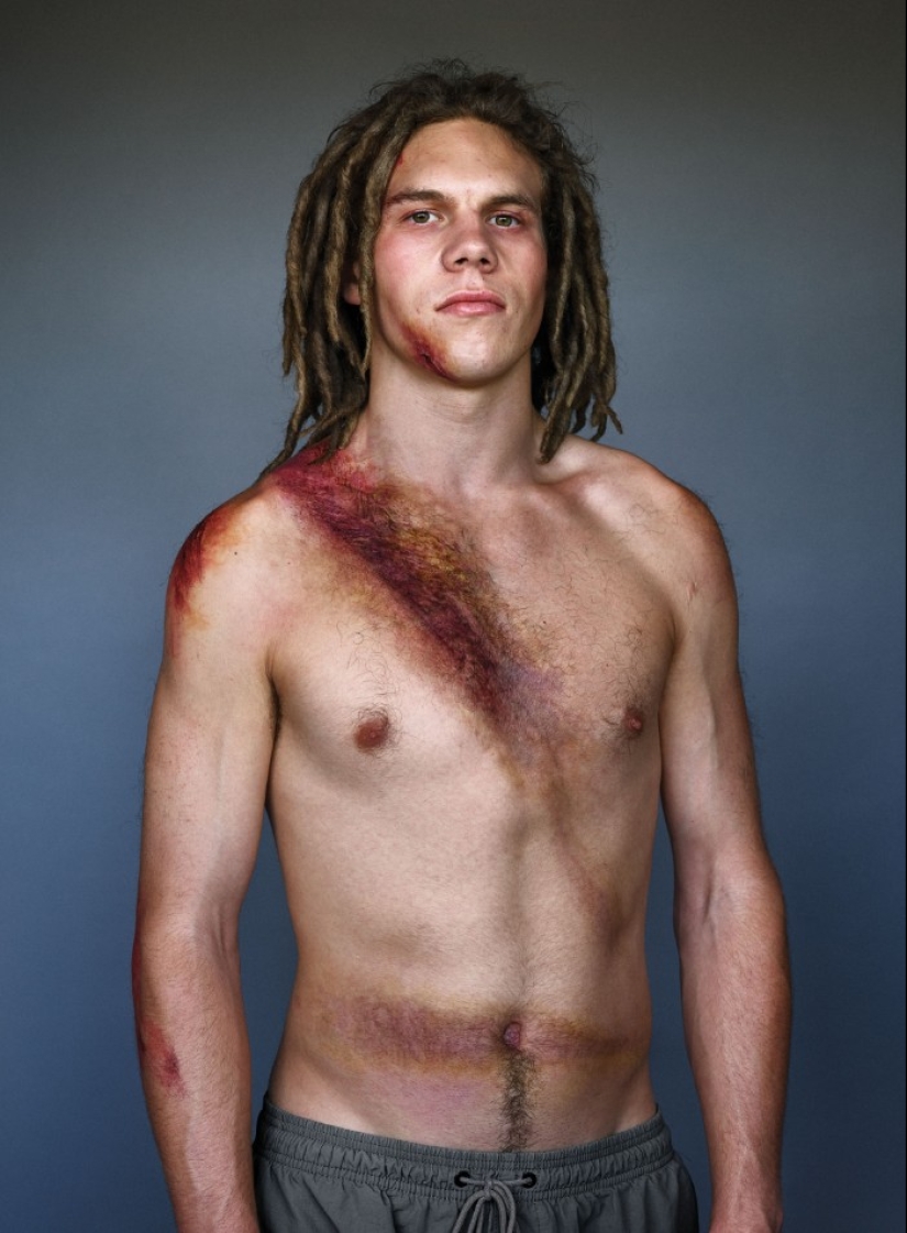Belt survivors: 10 magnificent photos that will convince you to wear