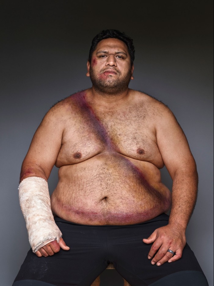 Belt survivors: 10 magnificent photos that will convince you to wear