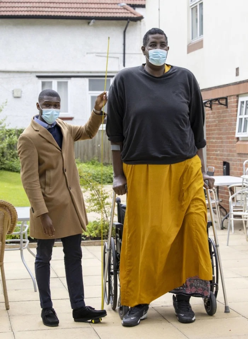 Big growth — big difficulties: how one of the tallest people in the world suffers