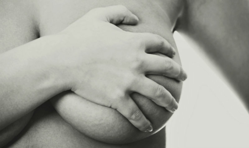 Breast augmentation 100 years ago. What was it like?