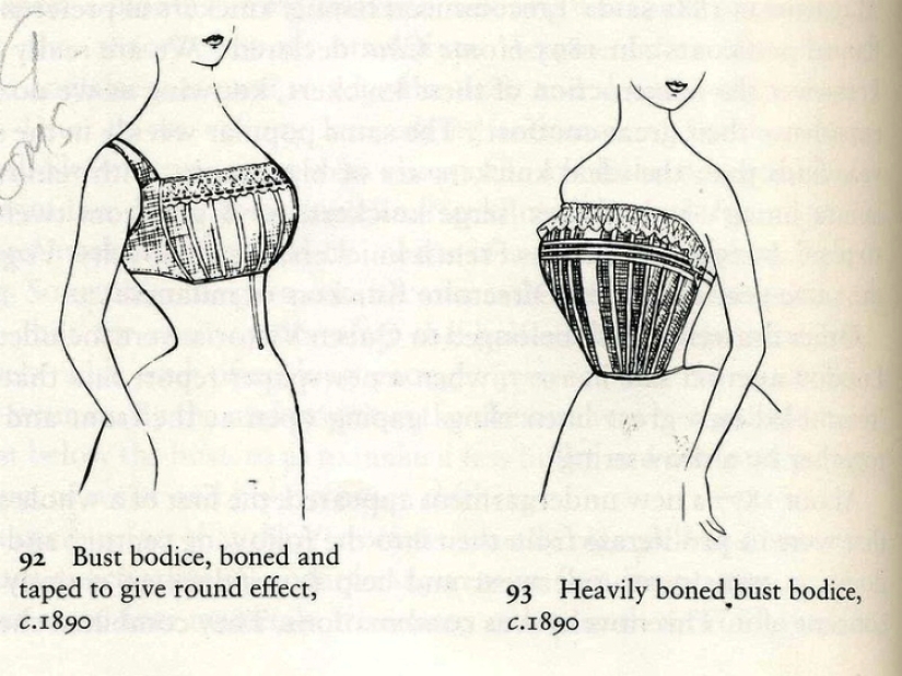 Breast augmentation 100 years ago. What was it like?