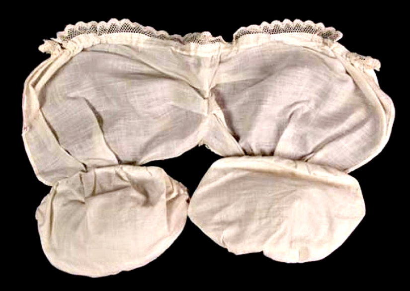 Breast augmentation 100 years ago. What was it like?