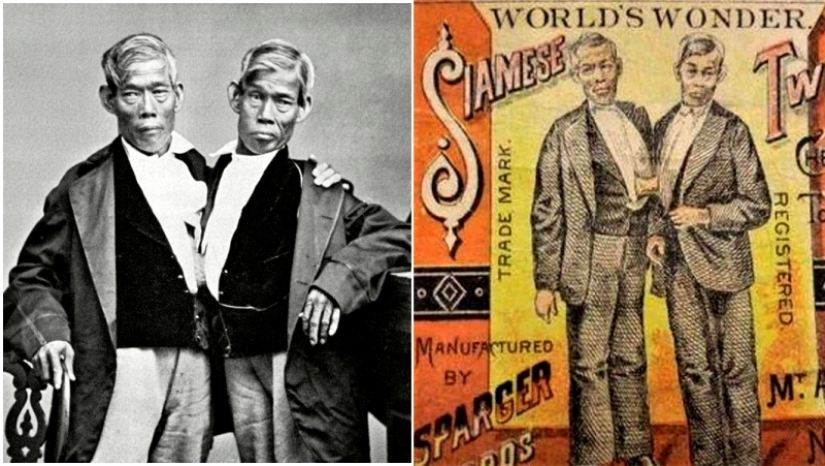 Chang and Eng Bunker: The Story of the Brothers Who Created the Concept of 'Siamese Twins'