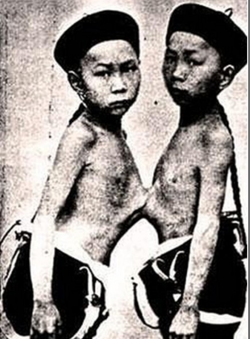 Chang and Eng Bunker: The Story of the Brothers Who Created the Concept of 'Siamese Twins'