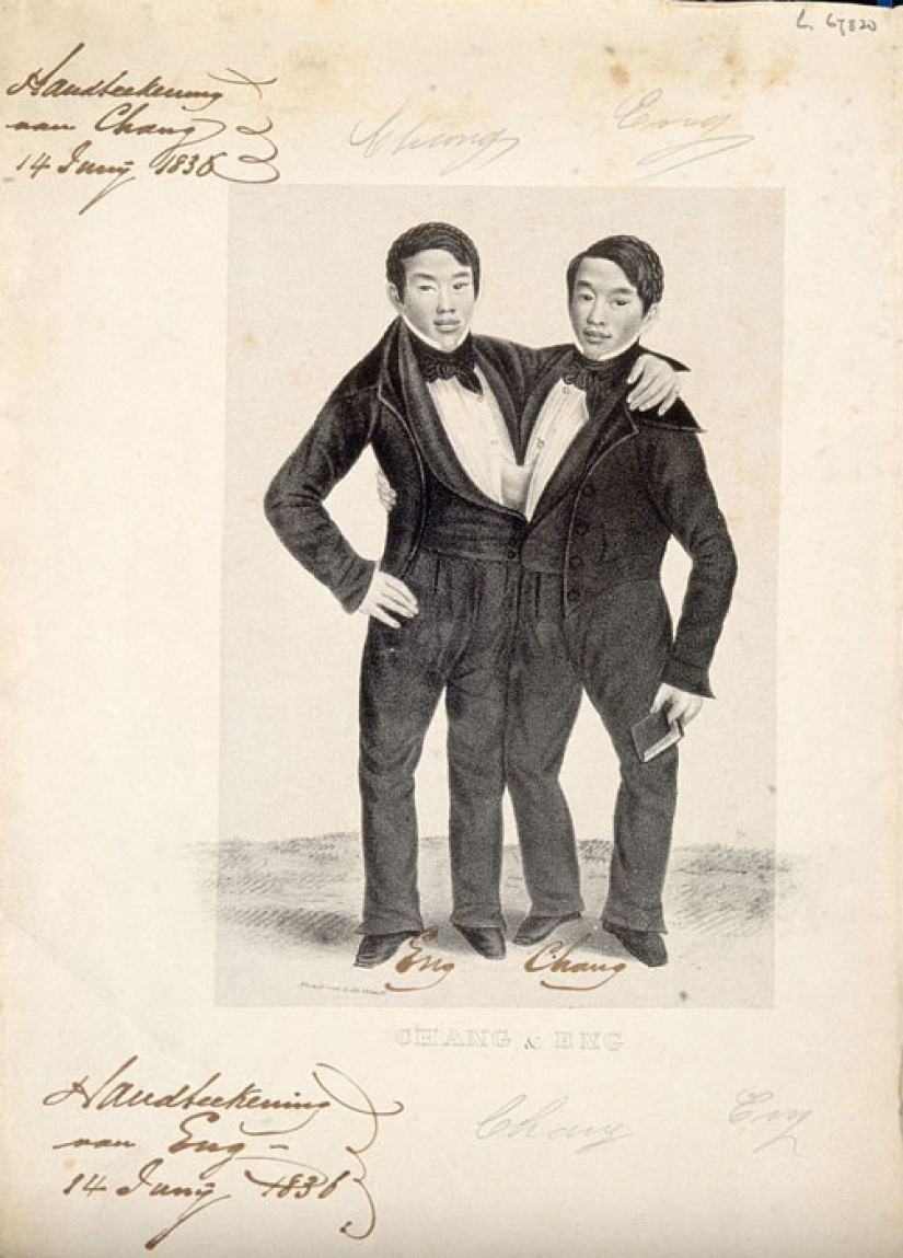 Chang and Eng Bunker: The Story of the Brothers Who Created the Concept of 'Siamese Twins'