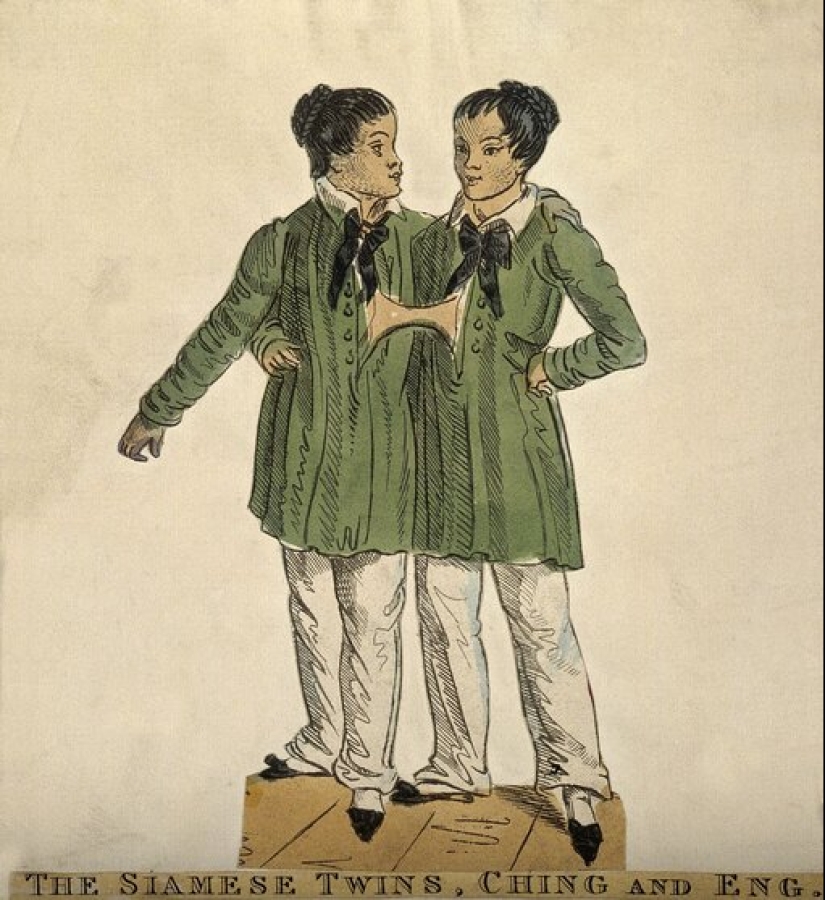 Chang and Eng Bunker: The Story of the Brothers Who Created the Concept of 'Siamese Twins'