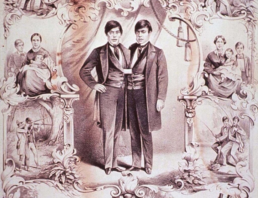 Chang and Eng Bunker: The Story of the Brothers Who Created the Concept of 'Siamese Twins'