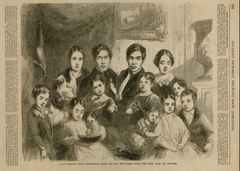 Chang and Eng Bunker: The Story of the Brothers Who Created the Concept of 'Siamese Twins'