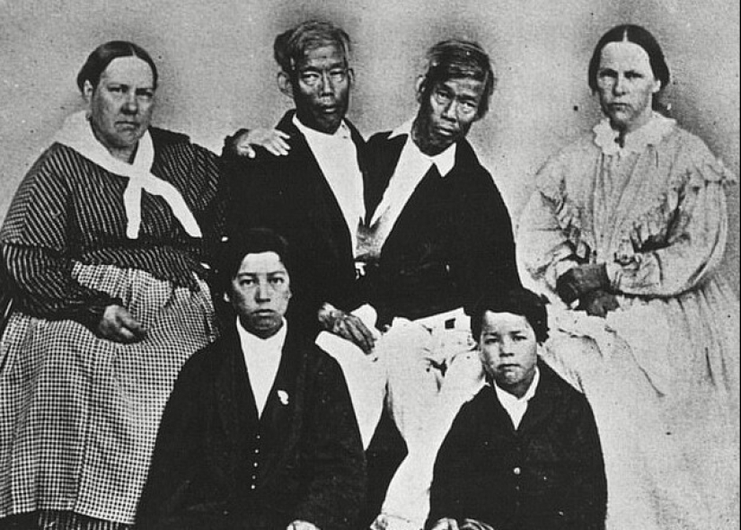 Chang and Eng Bunker: The Story of the Brothers Who Created the Concept of 'Siamese Twins'