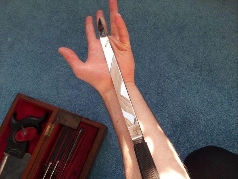 Cómo el doctor inglés Robert Liston mató a tres personas en una operación Cómo el doctor inglés Robert Liston mató a tres personas en una operación