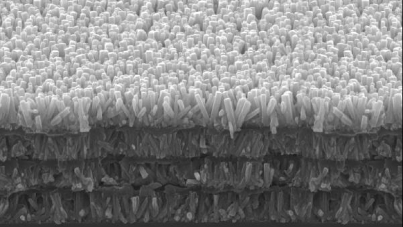 Cómo la caries se apoderó del mundo