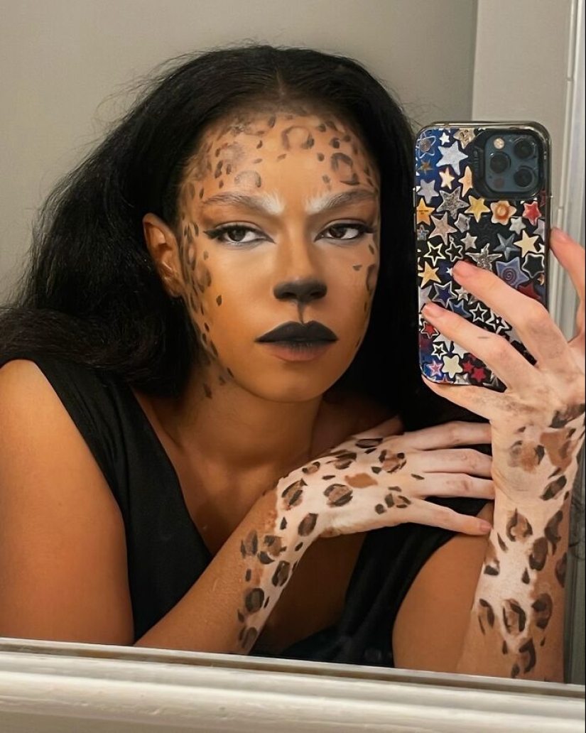 Dancer-Turned-Artist Amara Aleman Turns Her Vitiligo Into Vibrant Body Art