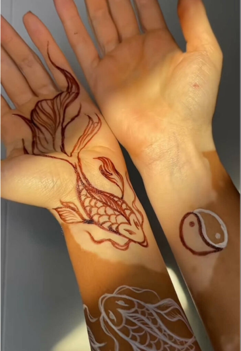 Dancer-Turned-Artist Amara Aleman Turns Her Vitiligo Into Vibrant Body Art