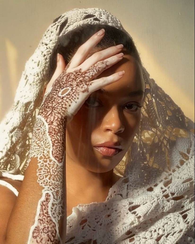 Dancer-Turned-Artist Amara Aleman Turns Her Vitiligo Into Vibrant Body Art