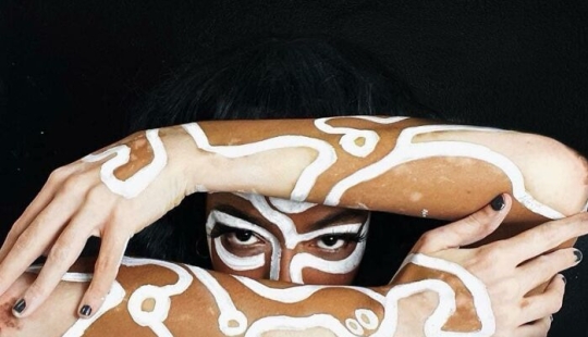 Dancer-Turned-Artist Amara Aleman Turns Her Vitiligo Into Vibrant Body Art