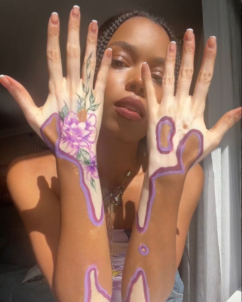 Dancer-Turned-Artist Amara Aleman Turns Her Vitiligo Into Vibrant Body Art