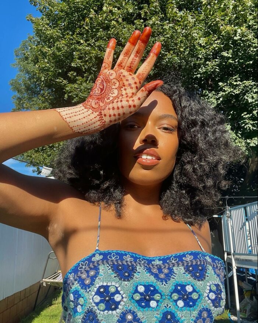 Dancer-Turned-Artist Amara Aleman Turns Her Vitiligo Into Vibrant Body Art