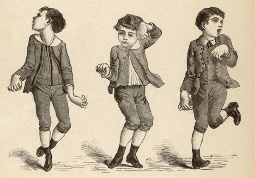 "Dancing plague" of the middle Ages — a deadly epidemic, the nature of which is still debated "Dancing plague" of the middle Ages — a deadly epidemic, the nature of which is still debated