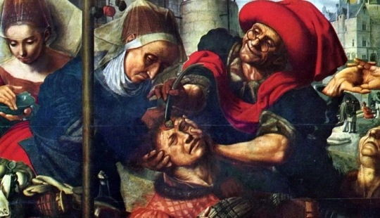 De Hipócrates a Pirogov: la cirugía de campo militar en diferentes épocas De Hipócrates a Pirogov: la cirugía de campo militar en diferentes épocas