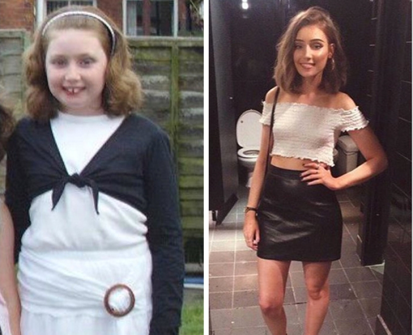 De un patito feo a un cisne hermoso: estos 18 adolescentes demostraron que cualquiera puede convertirse en un hombre guapo De un patito feo a un cisne hermoso: estos 18 adolescentes demostraron que cualquiera puede convertirse en un hombre guapo