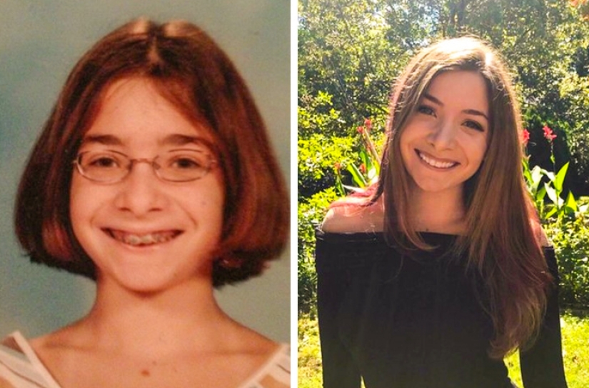 De un patito feo a un cisne hermoso: estos 18 adolescentes demostraron que cualquiera puede convertirse en un hombre guapo De un patito feo a un cisne hermoso: estos 18 adolescentes demostraron que cualquiera puede convertirse en un hombre guapo